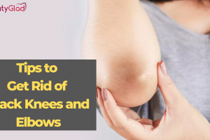 Tips on How to get rid of Black Knees and Elbow